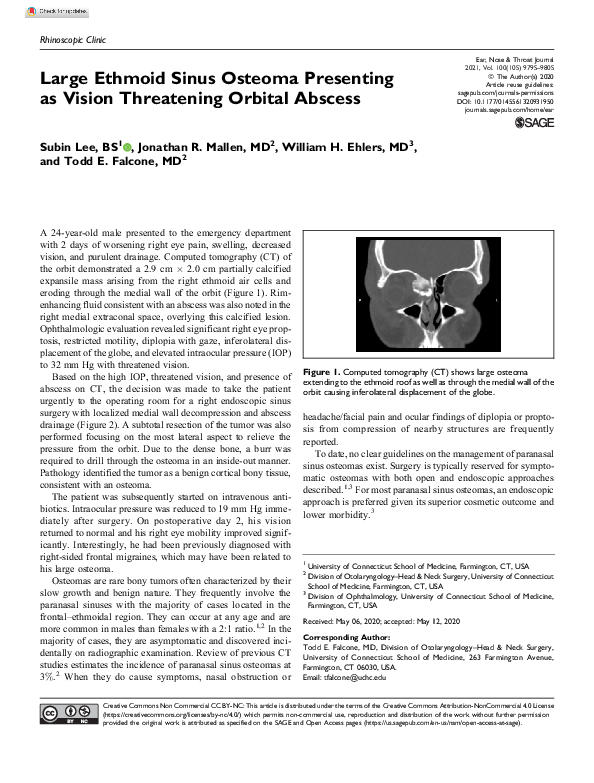 (PDF) Large Ethmoid Sinus Osteoma Presenting as Vision Threatening ...