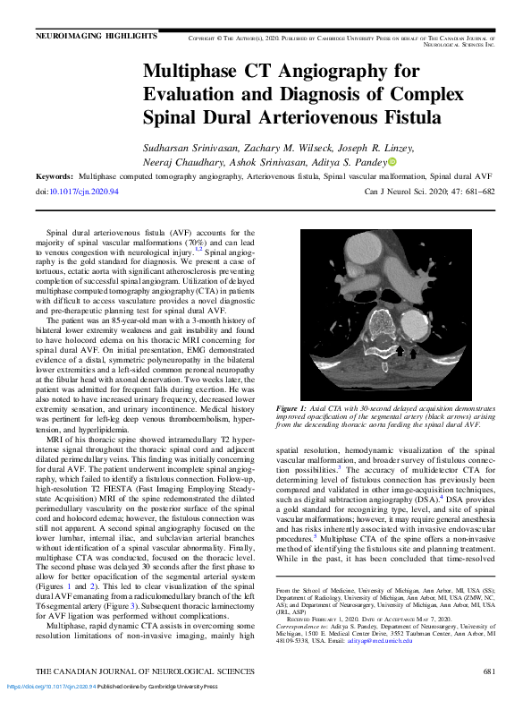 (PDF) Multiphase CT Angiography for Evaluation and Diagnosis of Complex ...