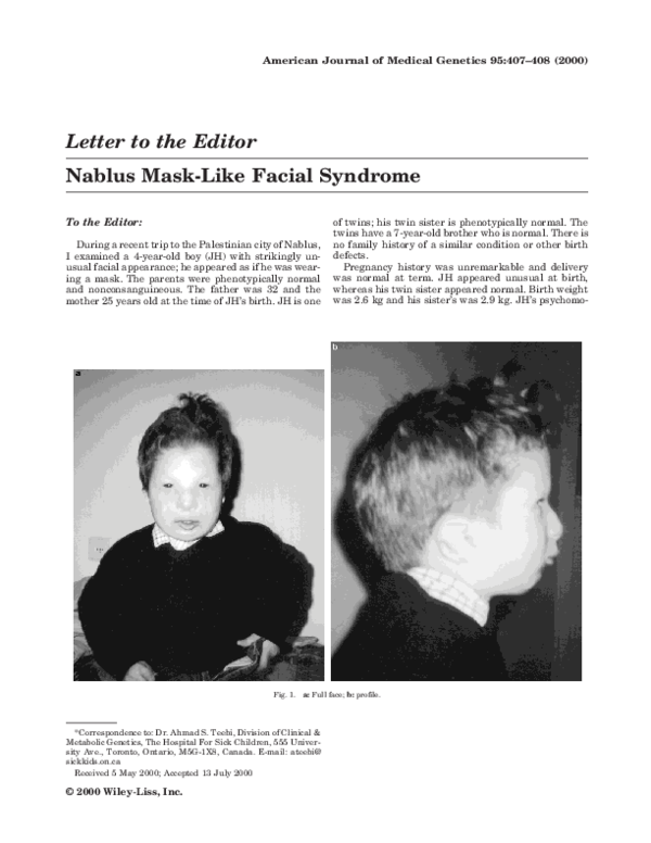 (PDF) Nablus masklike facial syndrome Susan Crocker Academia.edu