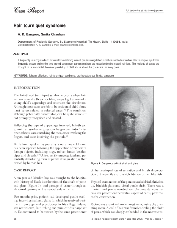 (PDF) Hair tourniquet syndrome Smita Chauhan Academia.edu