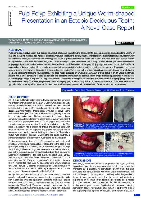 (PDF) Pulp Polyp Exhibiting a Unique Worm-shaped Presentation in an ...