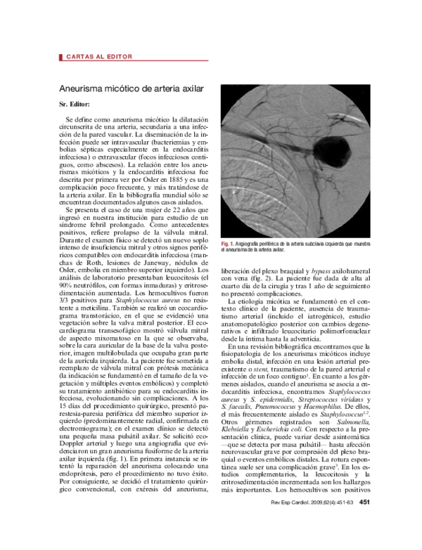 (PDF) Aneurisma micótico de arteria axilar | mariano norese - Academia.edu