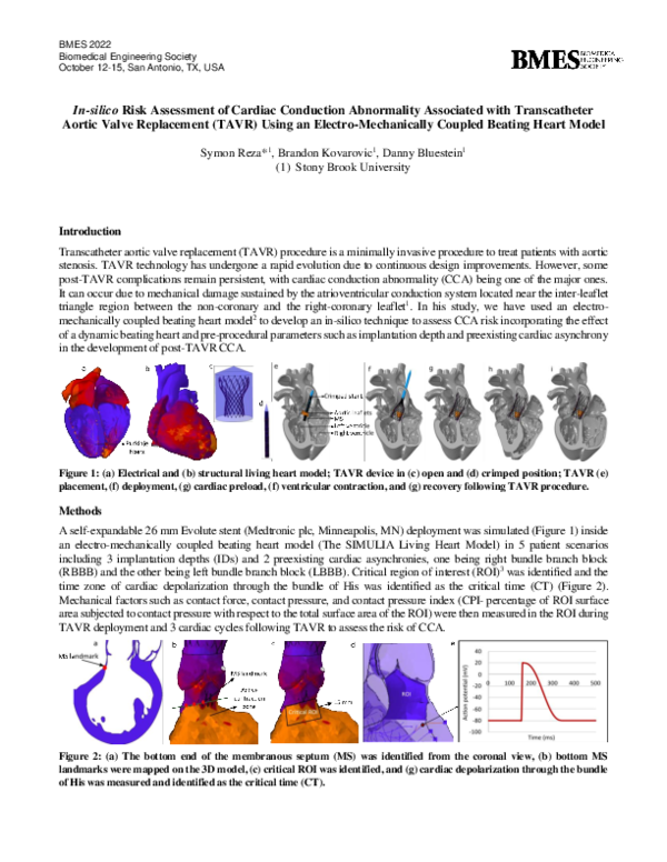 (PDF) In-silico Risk Assessment of Cardiac Conduction Abnormality ...