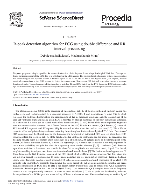 (PDF) R-Peak Detection Algorithm for Ecg using Double Difference And RR ...