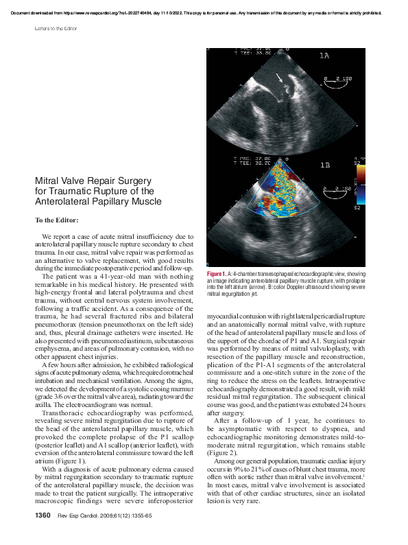 (PDF) Mitral Valve Repair Surgery for Traumatic Rupture of the ...