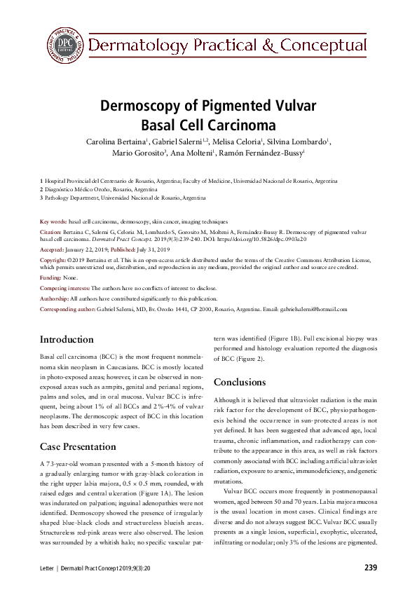 (PDF) Dermoscopy of Vulvar Pigmented Basal Cell Carcinoma | Ramón Bussy ...