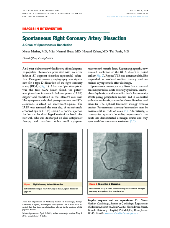 (PDF) Spontaneous Right Coronary Artery Dissection
