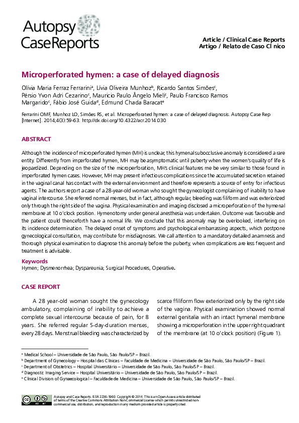 Unwanted Hymen Tissue Diagnosis Removal Options - uufw8xf