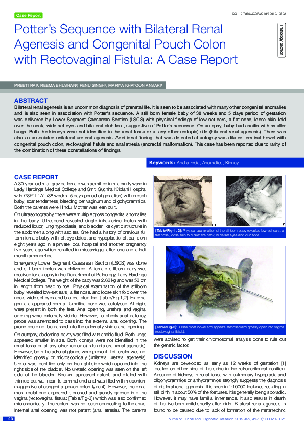 (PDF) Potter’s Sequence with Bilateral Renal Agenesis and Congenital