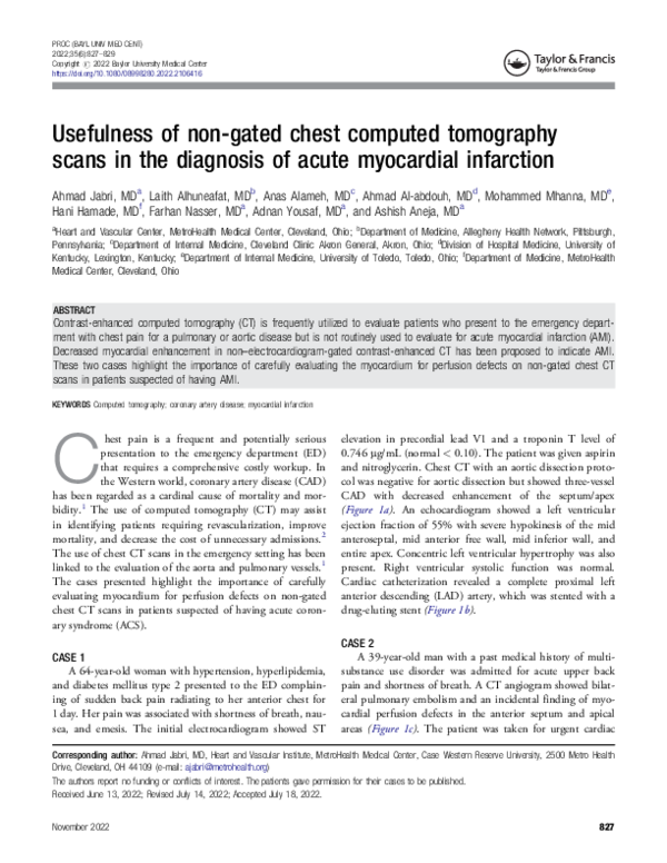 (PDF) Usefulness of non-gated chest computed tomography scans in the ...
