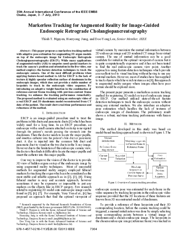 (PDF) Markerless tracking for augmented reality for image-guided ...