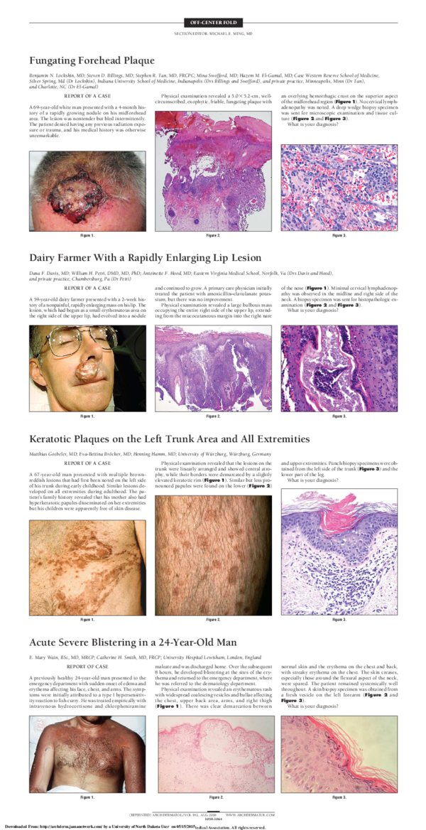(PDF) Fungating Forehead Plaque—Quiz Case