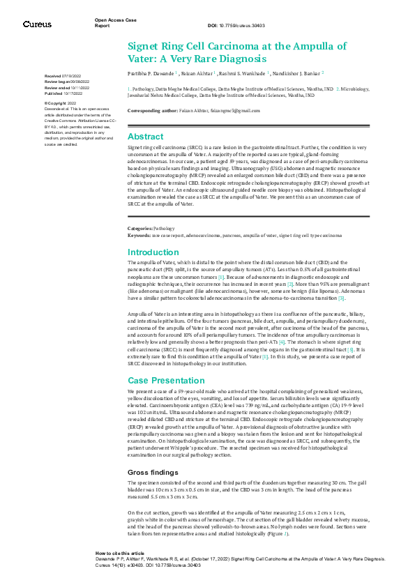 (PDF) Signet Ring Cell Carcinoma at the Ampulla of Vater: A Very Rare ...