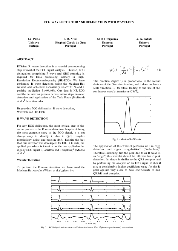 (PDF) ECG Wave Detector and Delineation with Wavelets