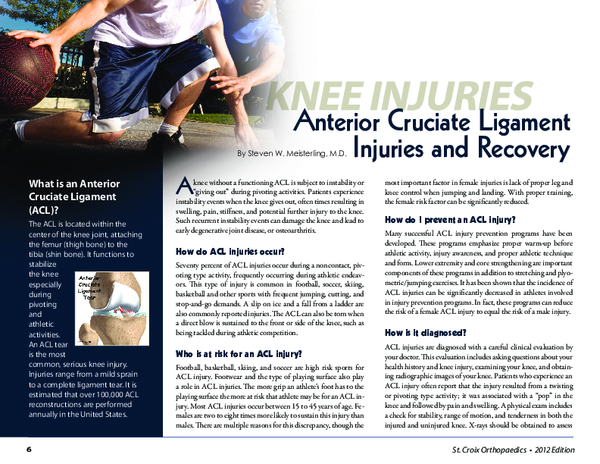 (PDF) Anterior cruciate ligament (ACL)