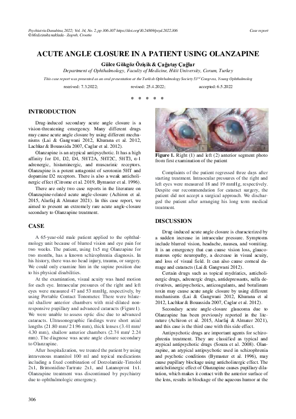 (PDF) Acute Angle Closure in a Patient Using Olanzapine
