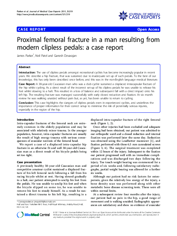 (PDF) Proximal femoral fracture in a man resulting from modern clipless
