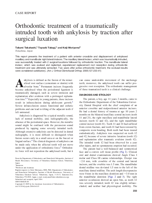 (PDF) Orthodontic treatment of a traumatically intruded tooth with ...
