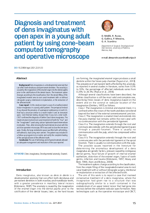 (PDF) Diagnosis and treatment of dens invaginatus with open apex in a ...