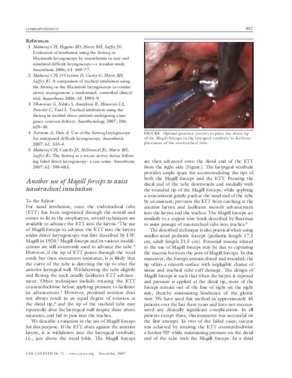 (PDF) Another use of Magill forceps to assist nasotracheal intubation
