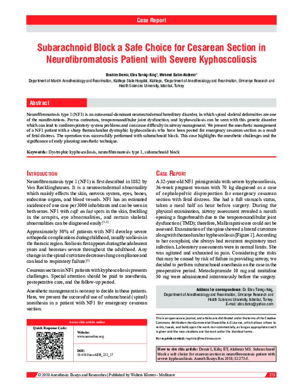 (PDF) Subarachnoid Block a Safe Choice for Cesarean Section in