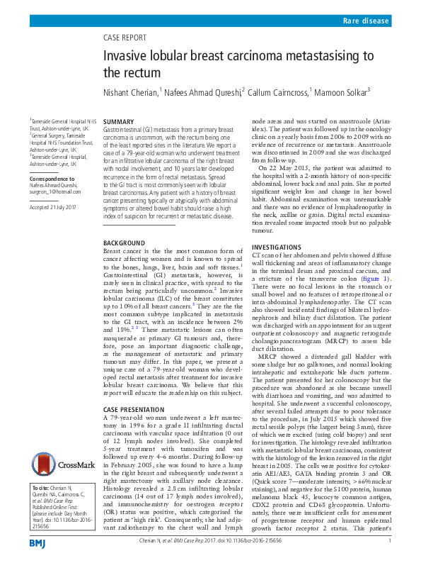 (PDF) Invasive lobular breast carcinoma metastasising to the rectum