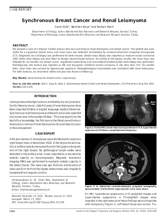 (PDF) Synchronous Breast Cancer and Renal Leiomyoma