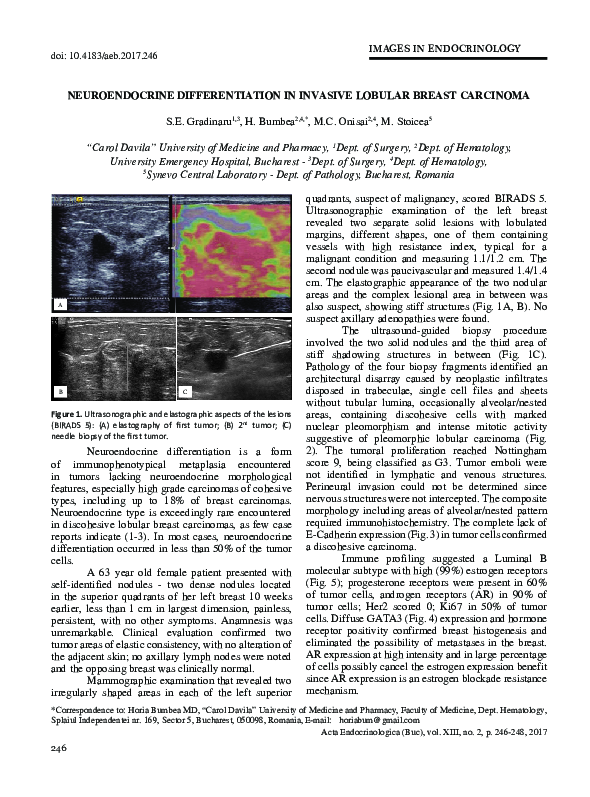 (PDF) Neuroendocrine Differentiation in Invasive Lobular Breast Carcinoma