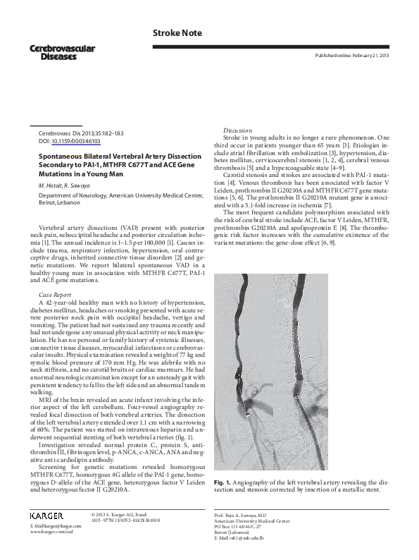 (PDF) Spontaneous Bilateral Vertebral Artery Dissection Secondary to ...