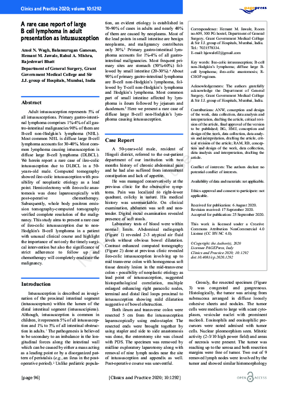 (PDF) A Rare Case Report of Large B Cell Lymphoma in Adult Presentation ...