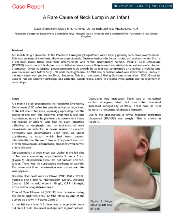 (PDF) A Rare Cause of Neck Lump in an Infant
