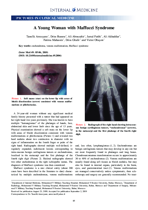 (PDF) A Young Woman with Maffucci Syndrome | abd idrissi - Academia.edu