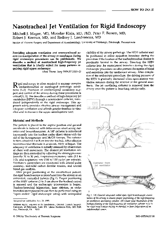 (PDF) Nasotracheal jet ventilation for rigid endoscopy Rodney