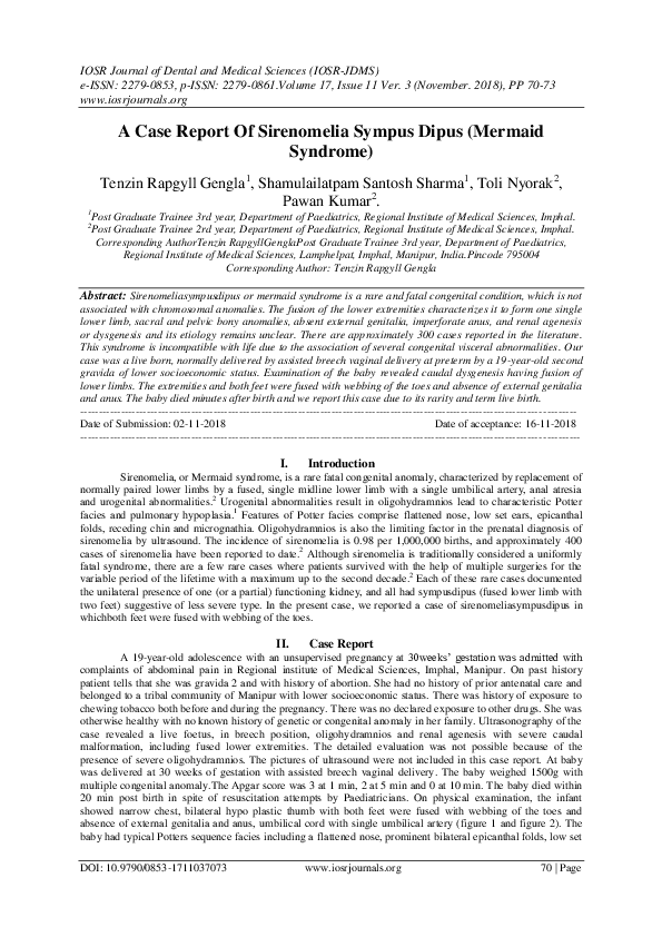 (PDF) A Case Report Of Sirenomelia Sympus Dipus ( Mermaid Syndrome )