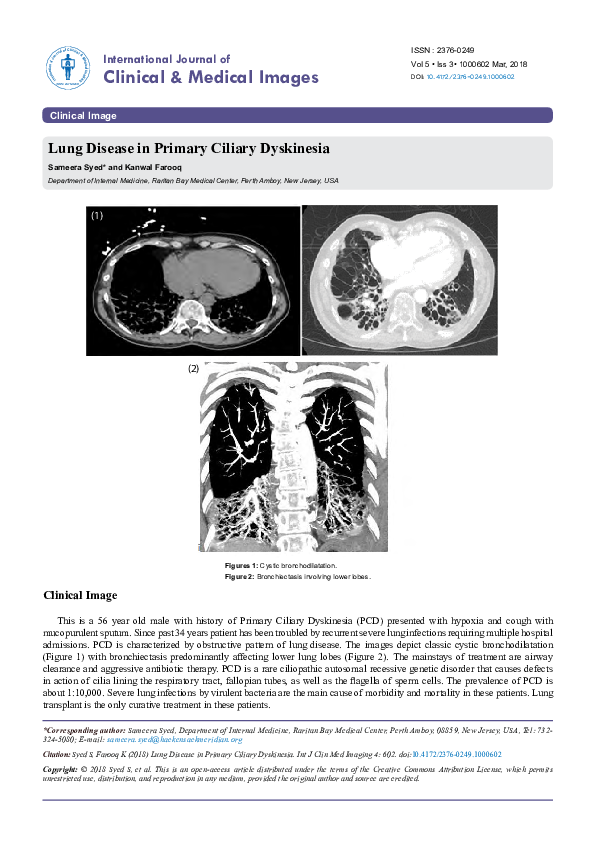 (PDF) Lung Disease in Primary Ciliary Dyskinesia