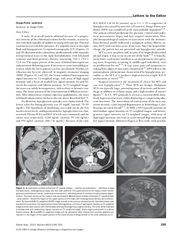(PDF) DoegePotter syndrome leandro accardo de mattos Academia.edu