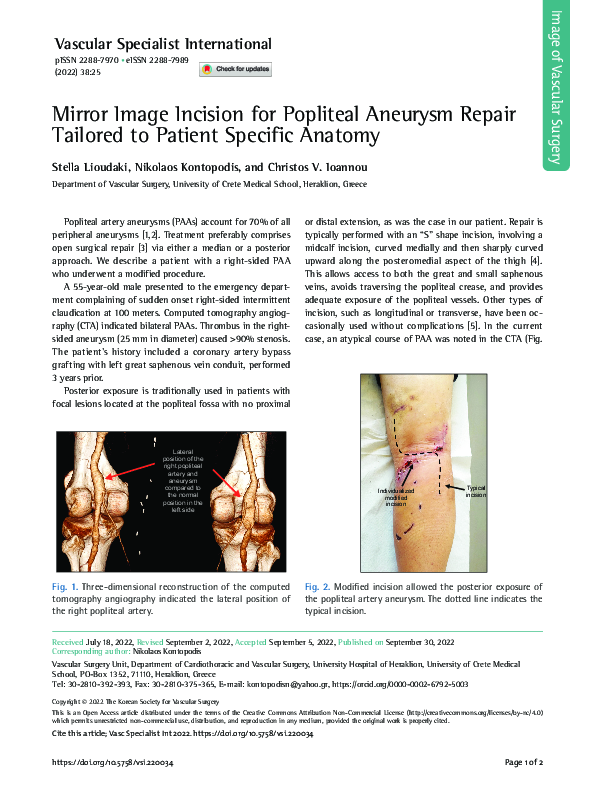 (PDF) Mirror Image Incision for Popliteal Aneurysm Repair Tailored to ...