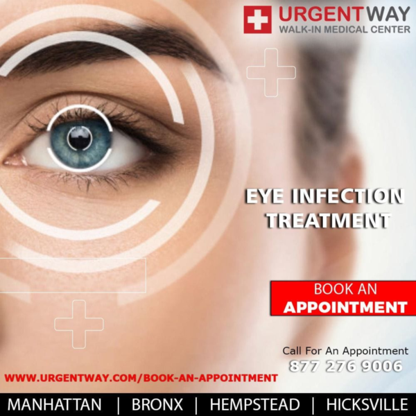 (PDF) Eye Infection