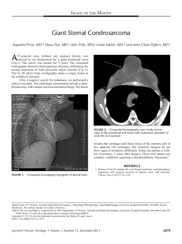 (PDF) Giant Sternal Condrosarcoma