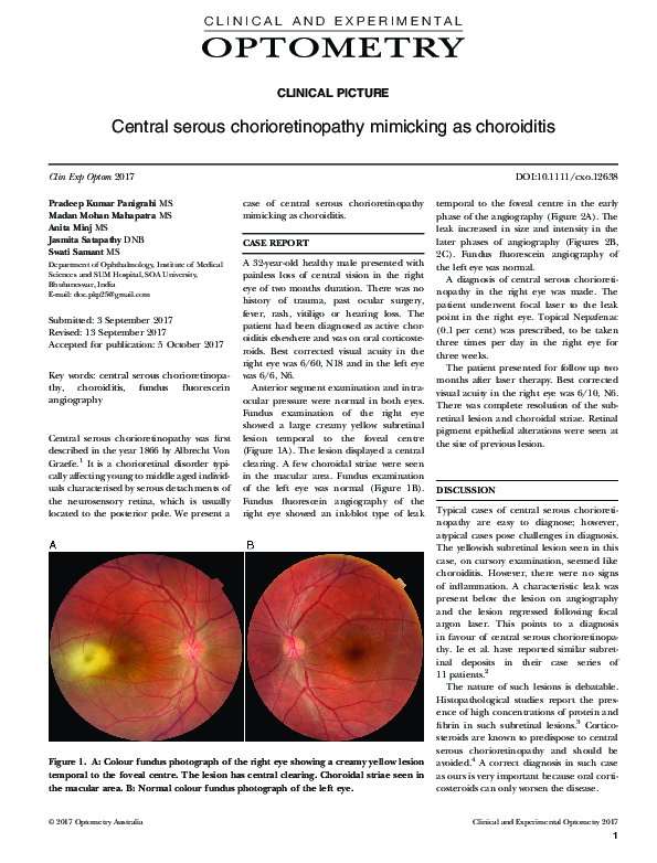 (PDF) Central serous chorioretinopathy mimicking as choroiditis