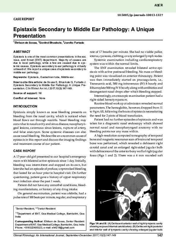 (PDF) Epistaxis Secondary to Middle Ear Pathology: A Unique Presentation