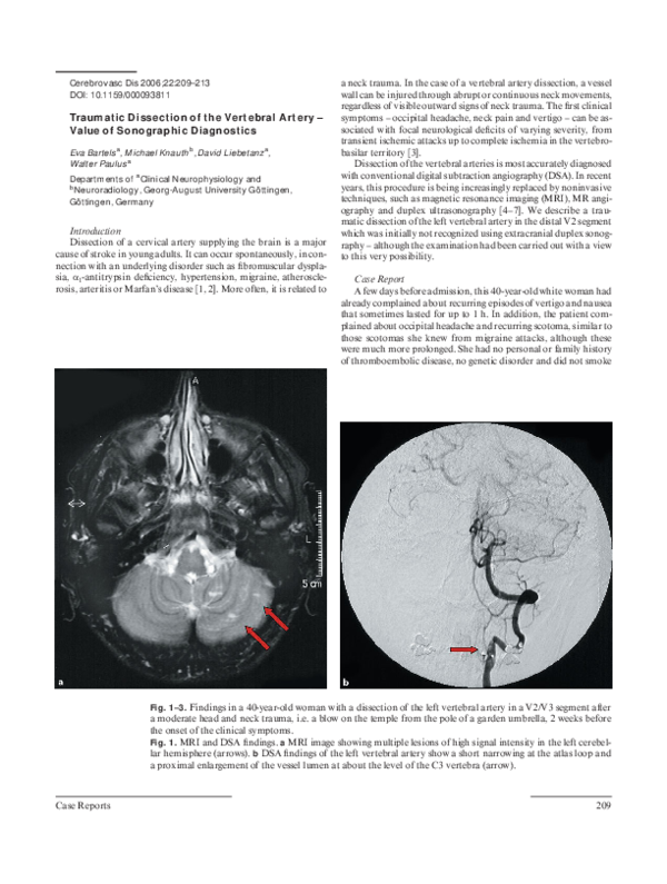 (PDF) Traumatic Dissection of the Vertebral Artery – Value of ...