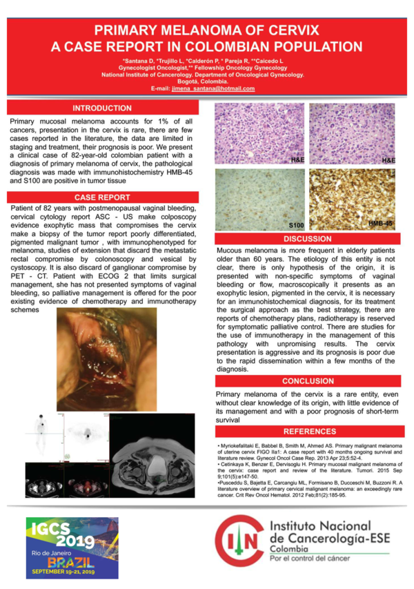 (PDF) Primary Melanoma of Cervix. A Case Report in Colombian Population