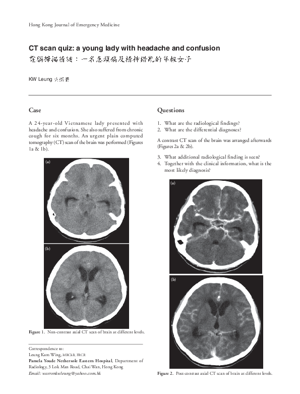 (PDF) CT Scan Quiz: A Young Lady with Headache and Confusion