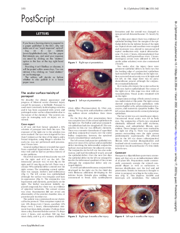 (PDF) Macular infarction after intravitreal amikacin: mounting evidence ...