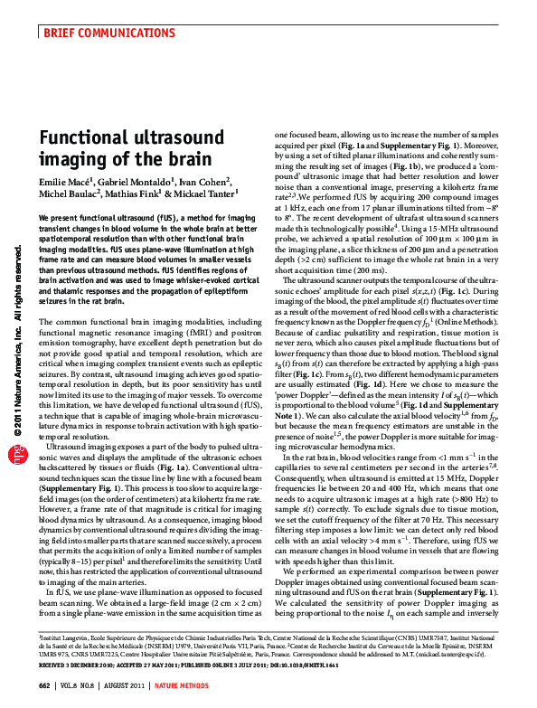 (PDF) Functional ultrasound imaging of the brain