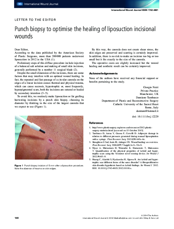 (PDF) Punch biopsy to optimise the healing of liposuction incisional