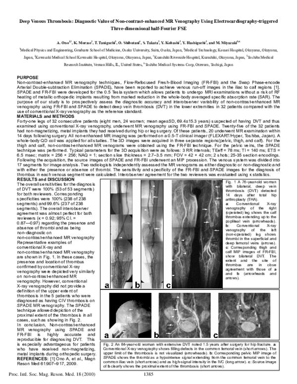(PDF) Deep venous thrombosis: Diagnostic value of non-contrast-enhanced ...