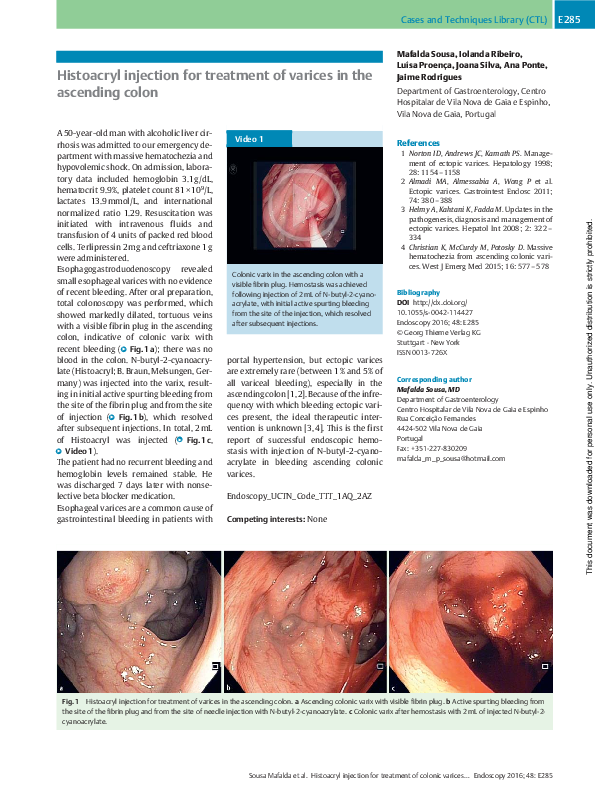 (PDF) Histoacryl injection for treatment of varices in the ascending colon