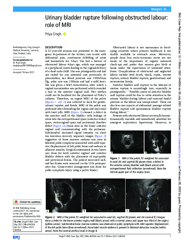 (PDF) Urinary bladder rupture following obstructed labour: role of MRI